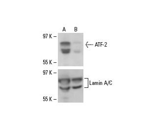 ATF-2 siRNA (h): sc-29205. Western blot analysis of ATF-2 expression in non-transfected control (A) and ATF-2 siRNA transf 
