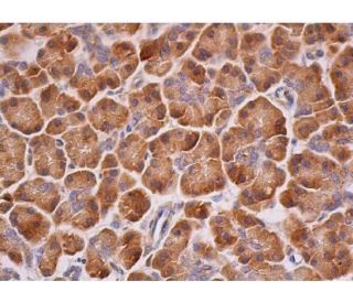 ATF-6α Antibody (F-7) | SCBT - Santa Cruz Biotechnology