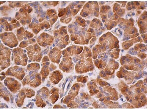 ATF-6α Antibody (F-7) | SCBT - Santa Cruz Biotechnology