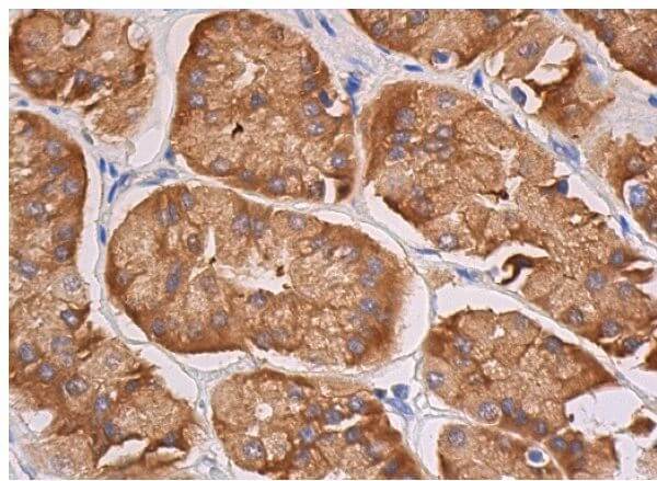 【sei】速達 ATF-6α Antibody (F-7) | SCBT - Santa Cruz Biotechnology