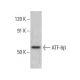 ATF-6β Antibody (4D10) - Western Blotting - Image 384042