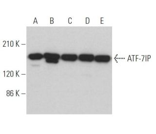 ATF-7IP Antibody (C-1) - Western Blotting - Image 366759 