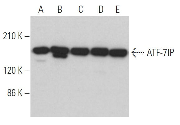 専用ページ ATF-7IP抗体(C-1) | SCBT - Santa Cruz Biotechnology