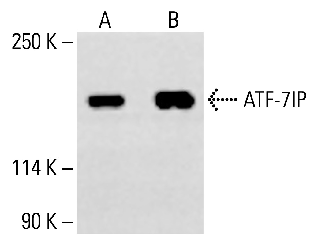 ATF-7IP抗体(C-1) | SCBT - Santa Cruz Biotechnology