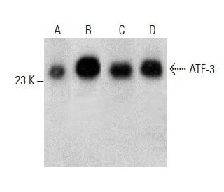 ATF3 Antibody (A-8) - Western Blotting - Image 387571Each CRISPR/Cas9 Knockout (KO) Plasmid product consists of a pool of 3 plasmids designed to ensure identification and cleavage of a specific gene for maximum knockout efficiency. Each plasmid encodes a unique 20 nt sequence derived from the GeCKO (v2) library. 