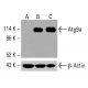 Atg9a Antibody (F-3): sc-518179. Western blot analysis of Atg9a expression in untreated (A) and chemically-treated (B, C) HCT-116 whole cell lysates. β-Actin (C4): sc-47778 used as loading control. Detection reagent used: m-IgG Fc BP-HRP: sc-525409. Atg9a Antibody (F-3) - Western Blotting - Image 416484