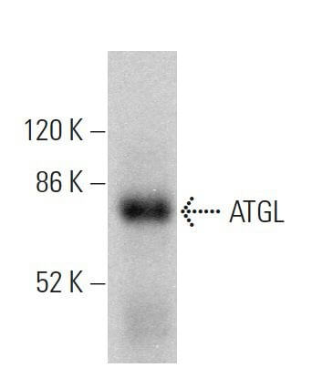 Anti-ATGL Antibody (F-7) | SCBT - Santa Cruz Biotechnology