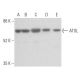 western blotting image from recommended ATGL (F-7) monoclonal antibody replacement. Image 354973