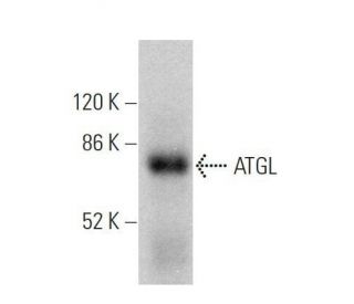 ATGL Antibody (F-7) - Western Blotting - Image 359686