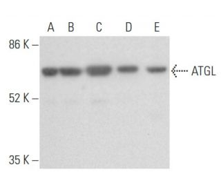ATGL Antibody (F-7) - Western Blotting - Image 354973The Double Nickase Plasmid features a U6 promoter for sgRNA expression, a 20 nt targeting sequence, and a gRNA scaffold to guide Cas9n. It includes a CBh promoter for Cas9n (D10A) and puromycin resistance, GFP for transfection verification, and nuclear localization signals (NLS). The 2A peptide allows co-expression of Cas9n and Puro from a single promoter, enabling precise genome editing with reduced off-target effects. 