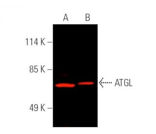 ATGL Antibody (F-7) - Western Blotting - Image 389762 