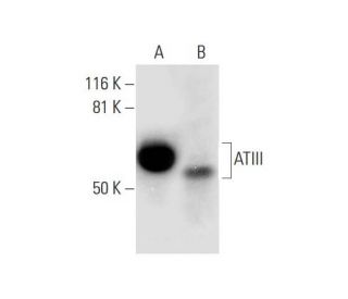 ATIII Antibody (A-6) - Western Blotting - Image 299013