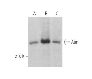 Atm Antibody (ATM 11G12) - Western Blotting - Image 352835 