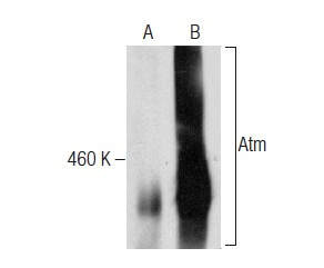 Anti-Atm Antibody (G-12) | SCBT - Santa Cruz Biotechnology