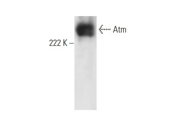 Atm Antibody G 12 SCBT Santa Cruz Biotechnology