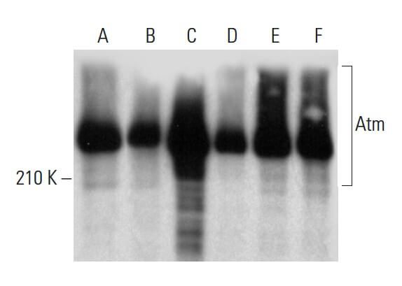 anti atm antibody g 12