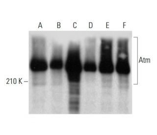 western blotting image from recommended Atm (G-12) monoclonal antibody replacement. Image 320283