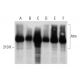 western blotting image from recommended Atm (G-12) monoclonal antibody replacement. Image 320283