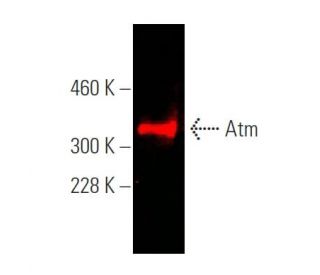 Atm Antibody (G-12) - Western Blotting - Image 375244The Double Nickase Plasmid features a U6 promoter for sgRNA expression, a 20 nt targeting sequence, and a gRNA scaffold to guide Cas9n. It includes a CBh promoter for Cas9n (D10A) and puromycin resistance, GFP for transfection verification, and nuclear localization signals (NLS). The 2A peptide allows co-expression of Cas9n and Puro from a single promoter, enabling precise genome editing with reduced off-target effects.
