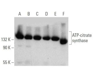 ATP-citrate synthase Antibody (5F8D11) - Western Blotting - Image 368288 