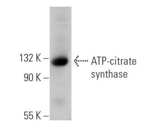 ATP-citrate synthase Antibody (5F8D11): m-IgG Fc BP-HRP Bundle