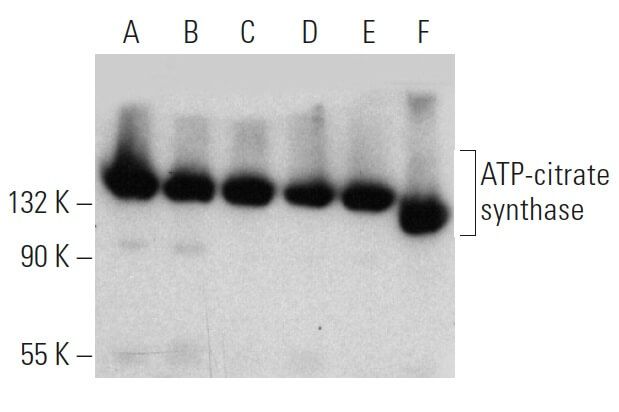 ATP-citrate synthase Antibody (5F8D11) | SCBT - Santa Cruz Biotechnology