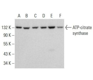 ATP-citrate synthase Antibody (5F8D11) - Western Blotting - Image 376493