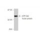 ATP13A2 Antibody (4B7) - Western Blotting - Image 349541