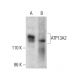ATP13A2 Antibody (4B7) - Western Blotting - Image 384270 