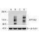 ATP13A2 Antibody (4B7) - Western Blotting - Image 414180 