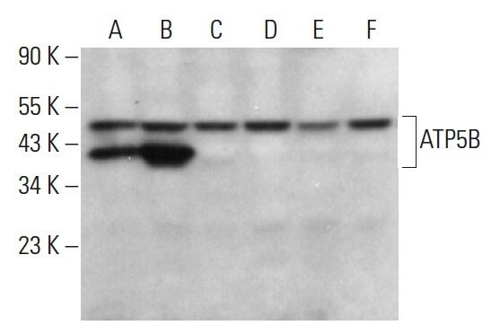 ATP5B抗体 (A-8) | SCBT - Santa Cruz Biotechnology