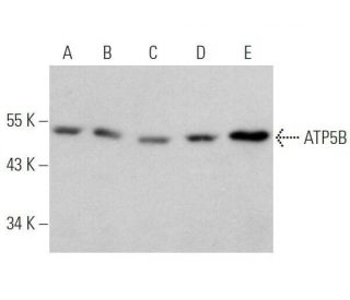 western blotting image from recommended ATP5B (E-1) monoclonal antibody replacement. Image 356242
