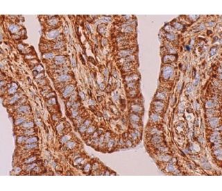 ATP5B Antibody (E-1) | SCBT - Santa Cruz Biotechnology