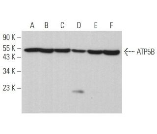 ATP5B Antibody (H-3) - Western Blotting - Image 375125 