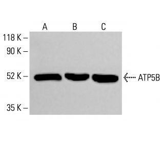 ATP5B Antibody (H-3) - Western Blotting - Image 413704