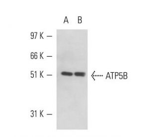ATP5B Antibody (E-1) - Western Blotting - Image 15452