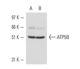 ATP5B Antibody (E-1) - Western Blotting - Image 15526