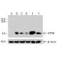 Anticorpo ATP5E (A-11): sc-393695. Análise por Western blot da expressão de ATP5E em lisados celulares inteiros de HeLa não tratados (A), HeLa tratados quimicamente (B, C), HCT-116 não tratados (D) e HCT-116 tratados quimicamente (E, F). β-Actina (C4): sc-47778 utilizada como controlo de carregamento. Reagente de deteção utilizado: m-IgG Fc BP-HRP: sc-525409. ATP5E Antibody (A-11) - Western Blotting - Image 415306
