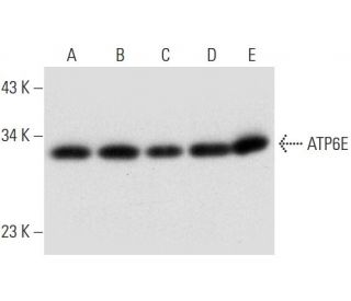 western blotting image from recommended ATP6E (G-3) monoclonal antibody replacement. Image 314041