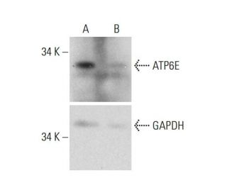 ATP6E CRISPR/CAS9 KO Plasmid (h): sc-404046. Western blot analysis of ATP6E expression in empty vector control (A) and ATP
