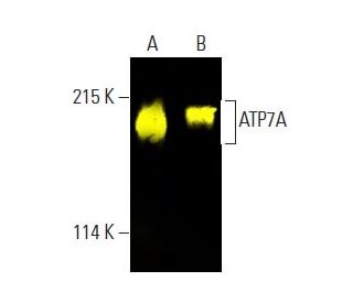 ATP7A Antibody (D-9) - Western Blotting - Image 397472The Double Nickase Plasmid features a U6 promoter for sgRNA expression, a 20 nt targeting sequence, and a gRNA scaffold to guide Cas9n. It includes a CBh promoter for Cas9n (D10A) and puromycin resistance, GFP for transfection verification, and nuclear localization signals (NLS). The 2A peptide allows co-expression of Cas9n and Puro from a single promoter, enabling precise genome editing with reduced off-target effects.