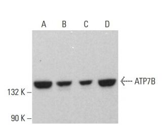 western blotting image from recommended ATP7B (A-11) monoclonal antibody replacement. Image 375358