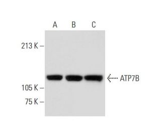 ATP7B Antibody (A-11) - Western Blotting - Image 297458