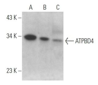 ATPBD4 Antibody (G-6) - Western Blotting - Image 369069 