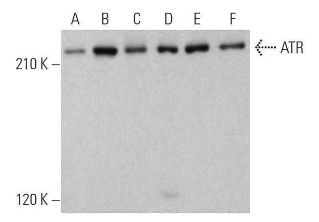 ATR Antibody (N-19) | SCBT - Santa Cruz Biotechnology