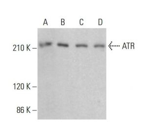 ATR Antibody (C-1) - Western Blotting - Image 380520SAM Transcription Activation: SAM system utilizing dCas9-VP64, MS2-P65-HSF1, and sgRNA for precise gene transcription activation.