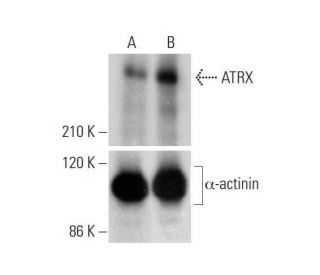 ATRX CRISPR Activation Plasmid (h): sc-400454-ACT. Western blot analysis of ATRX expression in non-transfected control (A) 