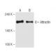 Attractin Antibody (9H8) - Western Blotting - Image 62828