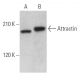 Attractin Antibody (D-8) - Western Blotting - Image 366837