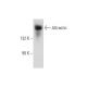 Attractin Antibody (F-2) - Western Blotting - Image 314084